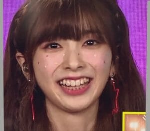 ミイヒ吐きダコ激痩せほうれい線