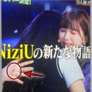 ミイヒ吐きダコ激痩せほうれい線