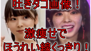 ミイヒ吐きダコ激痩せほうれい線