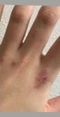 ミイヒ吐きダコ激痩せほうれい線