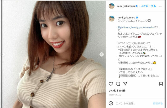 薬丸玲美ブサイク口元